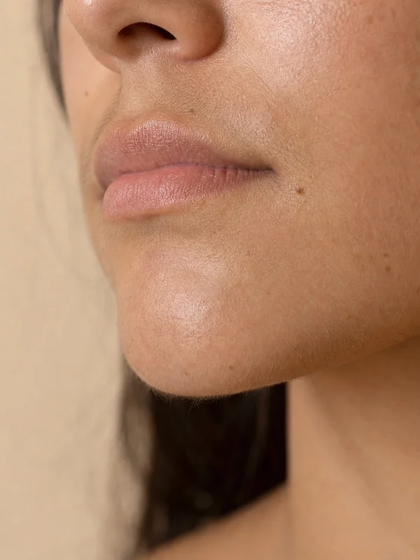 Unwanted Hair Growth