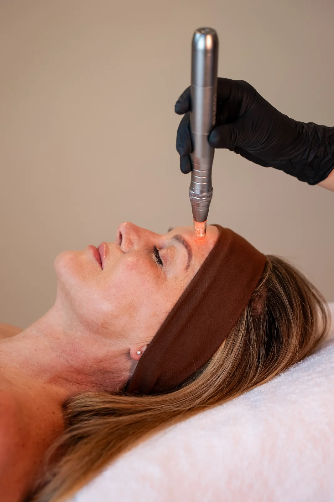 AquaPeel + Microneedling + LED facial bij SKIN Amsterdam