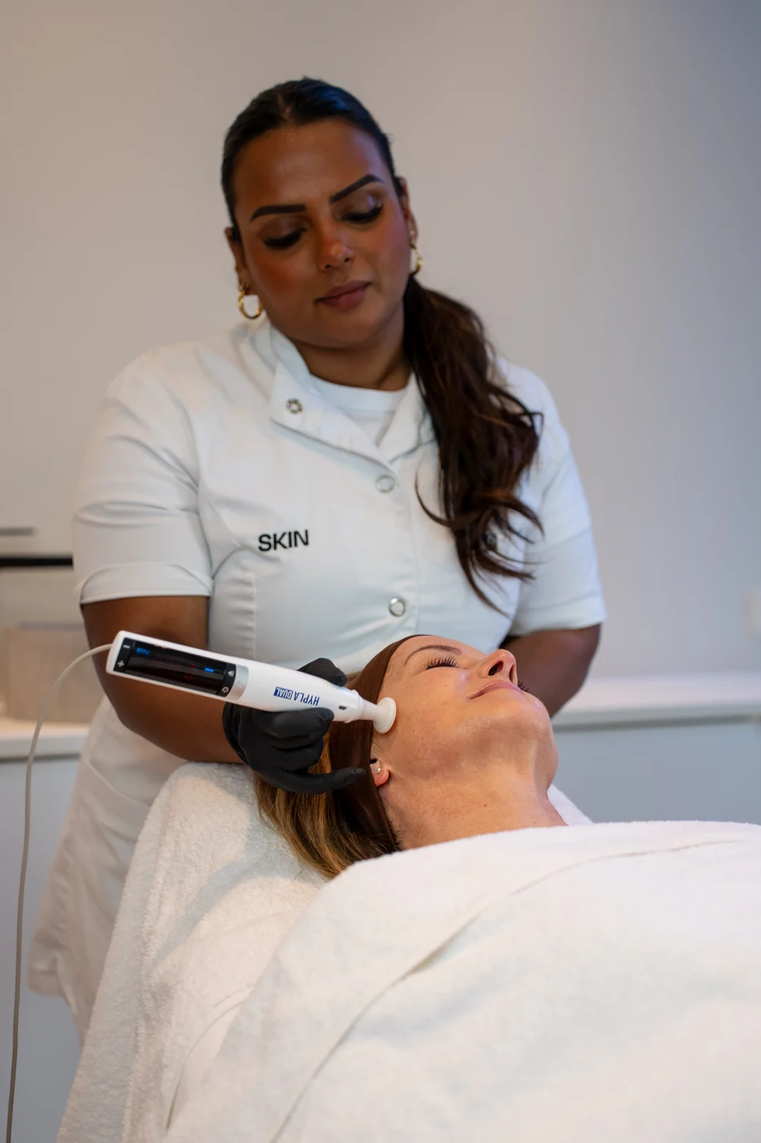 Acne Behandeling