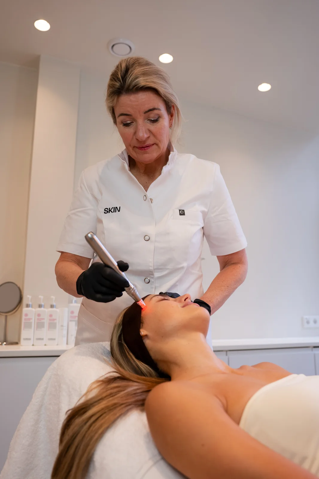 Microneedling met Exosomen