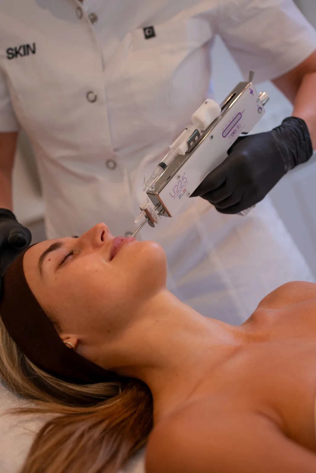 Mesotherapie behandeling bij SKIN Amsterdam — U225 meso-gun op het gezicht