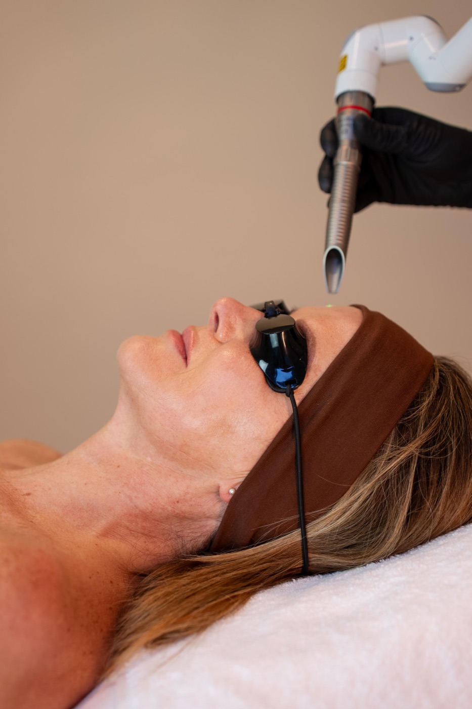 Fotona 4D laserbehandeling bij SKIN Amsterdam — huidverstrakking en versteviging